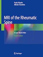 MRI of the Rheumatic Spine