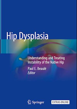 Hip Dysplasia