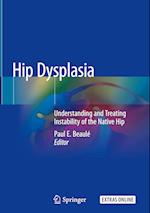 Hip Dysplasia