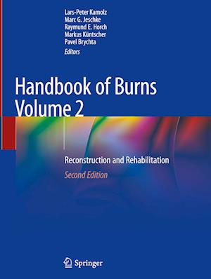 Handbook of Burns Volume 2