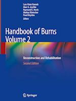 Handbook of Burns Volume 2