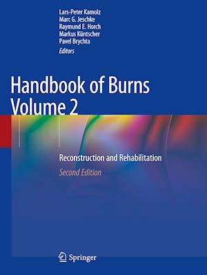 Handbook of Burns Volume 2