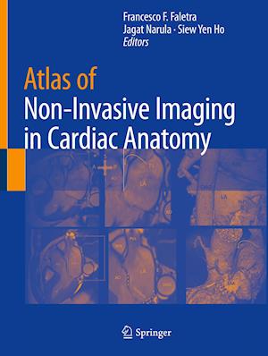 Atlas of Non-Invasive Imaging in Cardiac Anatomy