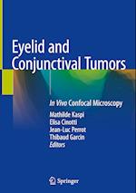 Eyelid and Conjunctival Tumors