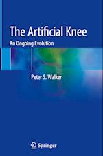 The Artificial Knee