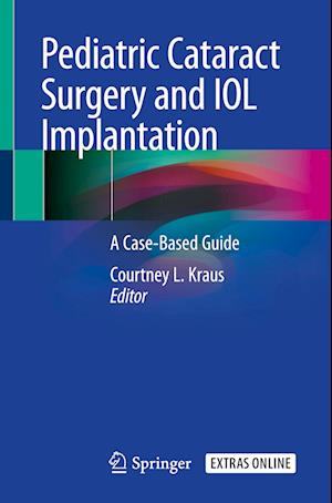 Pediatric Cataract Surgery and IOL Implantation