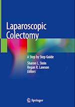 Laparoscopic Colectomy