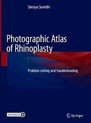 Photographic Atlas of Rhinoplasty