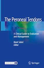The Peroneal Tendons