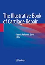 The Illustrative Book of Cartilage Repair