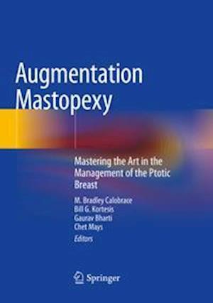 Augmentation Mastopexy