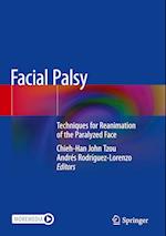 Facial Palsy