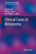 Clinical Cases in Melanoma