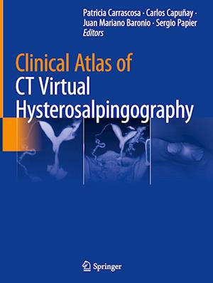 Clinical Atlas of CT Virtual Hysterosalpingography
