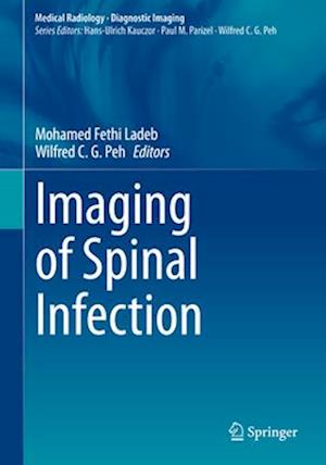 Imaging of Spinal Infection