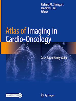 Atlas of Imaging in Cardio-Oncology