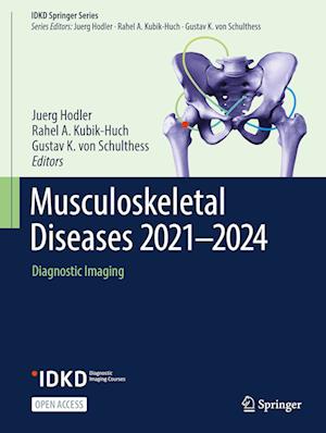 Musculoskeletal Diseases 2021-2024