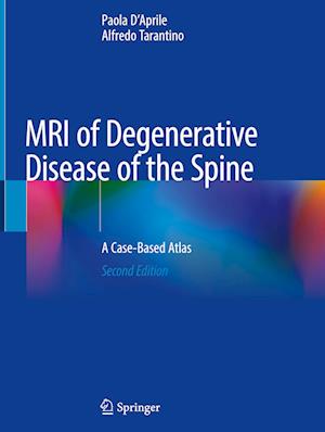 MRI of Degenerative Disease of the Spine