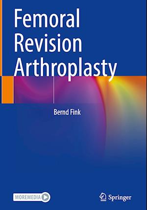 Femoral Revision Arthroplasty