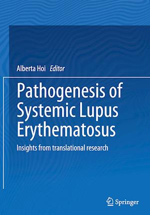 Pathogenesis of Systemic Lupus Erythematosus