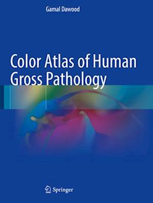 Color Atlas of Human Gross Pathology