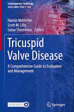 Tricuspid Valve Disease