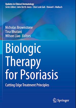 Biologic Therapy for Psoriasis