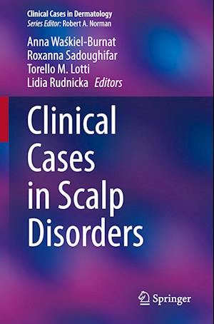 Clinical Cases in Scalp Disorders