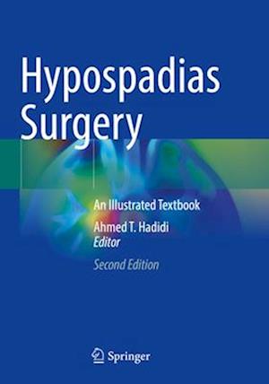 Hypospadias Surgery