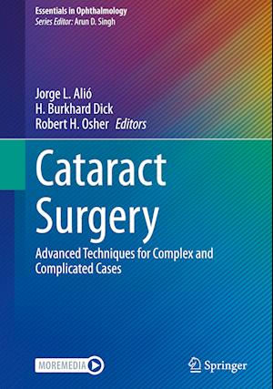 Cataract Surgery