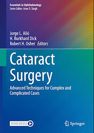 Cataract Surgery