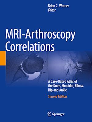 MRI-Arthroscopy Correlations