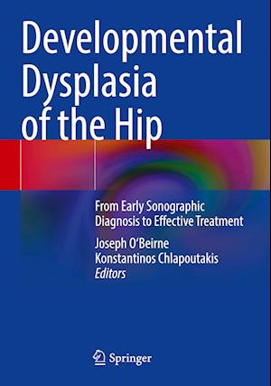 Developmental Dysplasia of the Hip