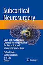 Subcortical Neurosurgery