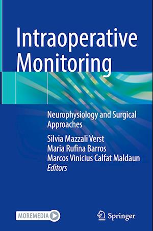 Intraoperative Monitoring