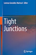 Tight Junctions 