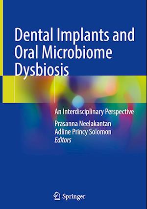 Dental Implants and Oral Microbiome Dysbiosis