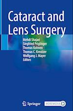 Cataract and Lens Surgery