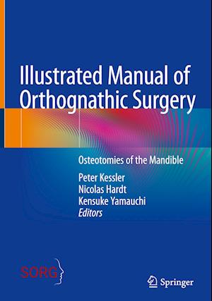 Illustrated Manual of Orthognathic Surgery