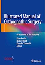 Illustrated Manual of Orthognathic Surgery