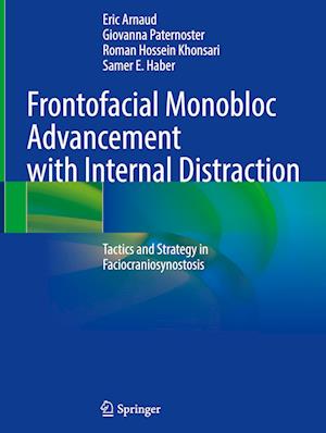 Frontofacial Monobloc Advancement with Internal Distraction