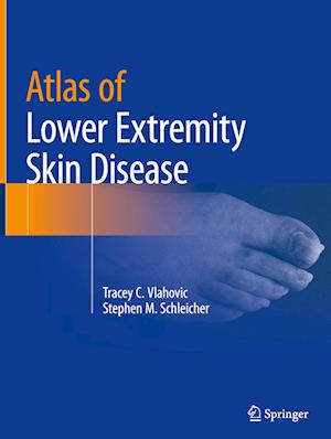 Atlas of Lower Extremity Skin Disease