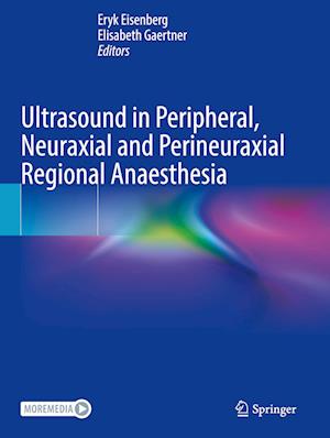 Ultrasound in Peripheral, Neuraxial and Perineuraxial Regional Anaesthesia