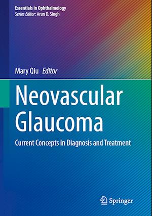 Neovascular Glaucoma