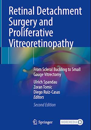 Retinal Detachment Surgery and Proliferative Vitreoretinopathy