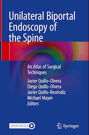 Unilateral Biportal Endoscopy of the Spine