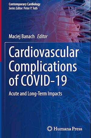 Cardiovascular Complications of COVID-19