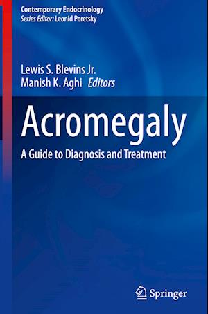 Acromegaly