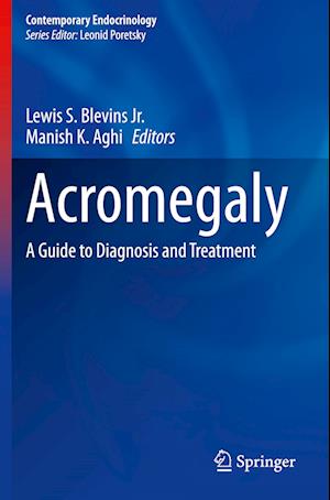 Acromegaly