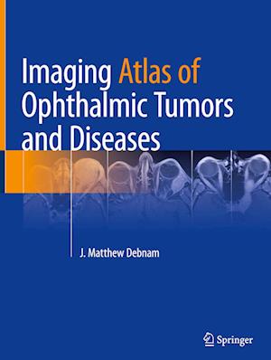 Imaging Atlas of Ophthalmic Tumors and Diseases